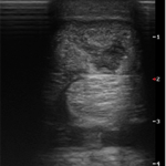 RenoVō® Case Study: Tendon Healing in a Competitive Warmblood Imaging 1