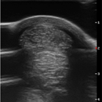 RenoVō® Case Study: Tendon Healing in a Competitive Warmblood Imaging 3